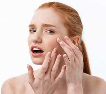 دلایل شایع جوش زدن صورت